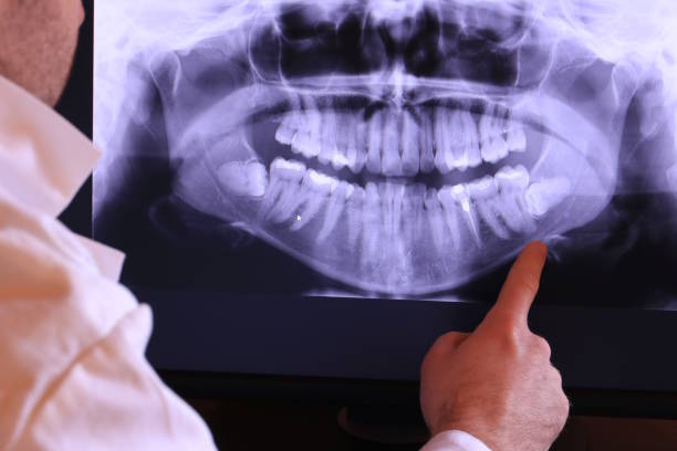 Best Broken or Chipped Tooth Repair in Marlene Village, OR