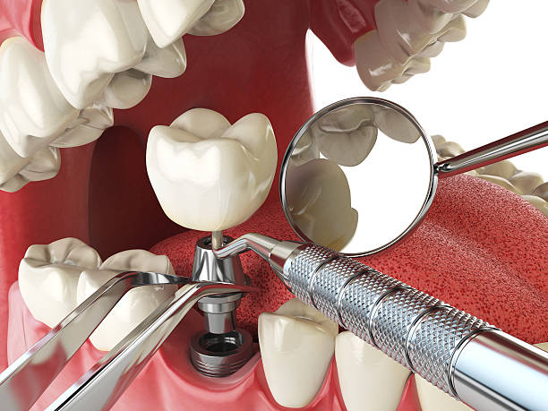 Best Dental Abscess Treatment in Marlene Village, OR